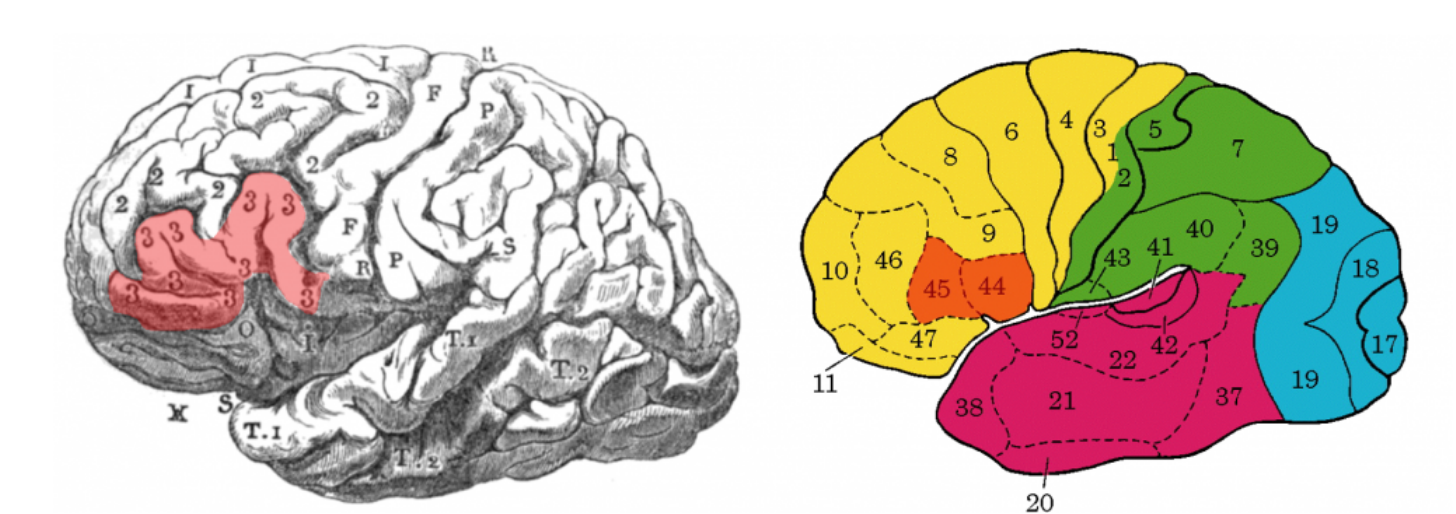 L-area-di-lesione-secondo-Broca-e-l-area-di-Broca-moderna L-area-di-lesione-secondo-Broca-e-l-area-di-Broca-moderna