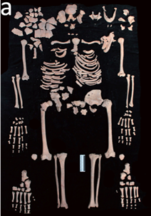 Madre e figlio morti di peste all�inizio della Morte Nera: un caso ligure di �coffin birth� del XIV secolo