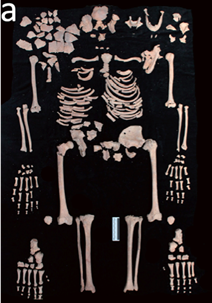 Madre e figlio morti di peste all’inizio della Morte Nera: un caso ligure di “coffin birth” del XIV secolo Madre e figlio morti di peste all’inizio della Morte Nera: un caso ligure di “coffin birth” del XIV secolo