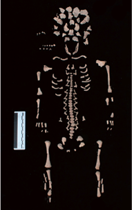 Madre e figlio morti di peste all’inizio della Morte Nera: un caso ligure di “coffin birth” del XIV secolo Madre e figlio morti di peste all’inizio della Morte Nera: un caso ligure di “coffin birth” del XIV secolo