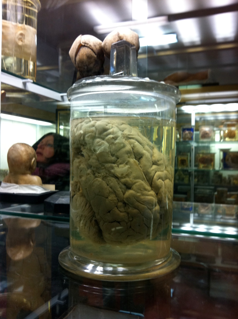 Monsieur-Tans-brain-Museue-Dupuytren-Parigi Monsieur-Tans-brain-Museue-Dupuytren-Parigi