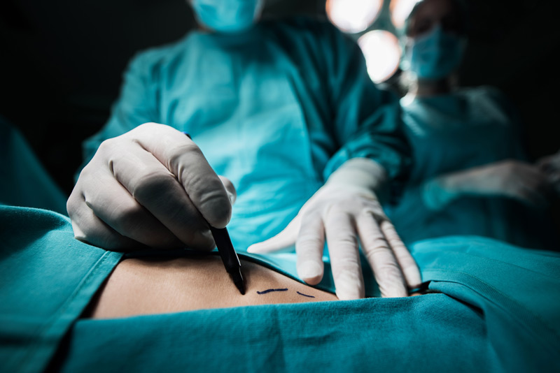 Chirurgia estetica: i �finti� specialisti Chirurgia estetica: i �finti� specialisti