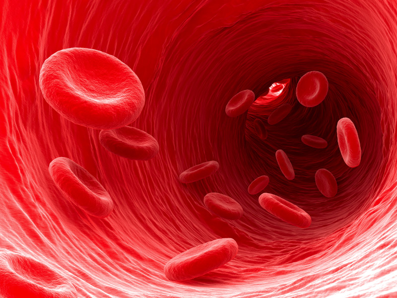 Il potere delle immagini di arterie danneggiate Il potere delle immagini di arterie danneggiate