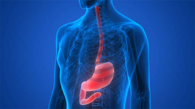 Tumore esofago-gastrico: dalla diagnosi alla cura